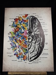 Brain Art Butterfly Anatomy Canvas Wall Art Human Canvas Print 15 X 11.5 Inch